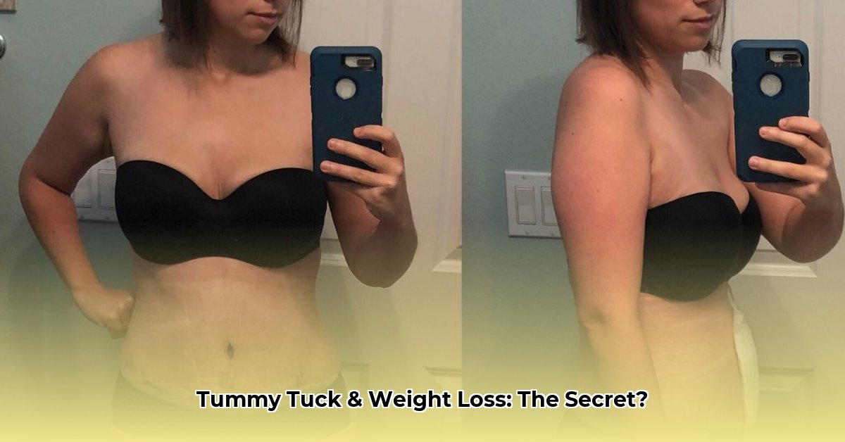 abdominoplasty-weight-loss